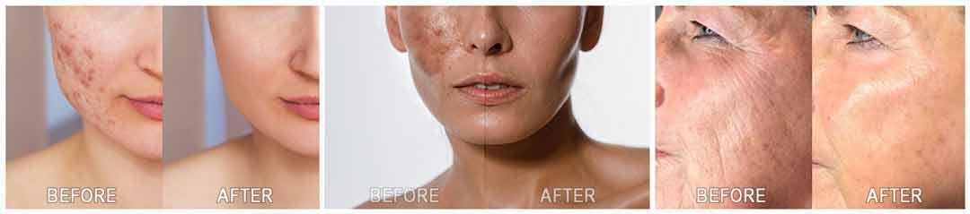 Kim’s Skincare Protocol Real User Experience